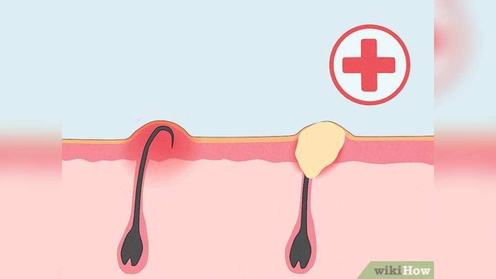 How to Care for Bikini Line After Waxing